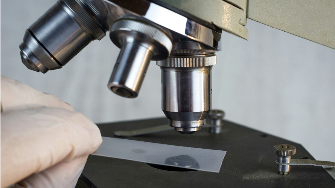 Vorschaubild: Prof. Dr. Volker Diehl engagiert sich für junge Erwachsene mit Krebs